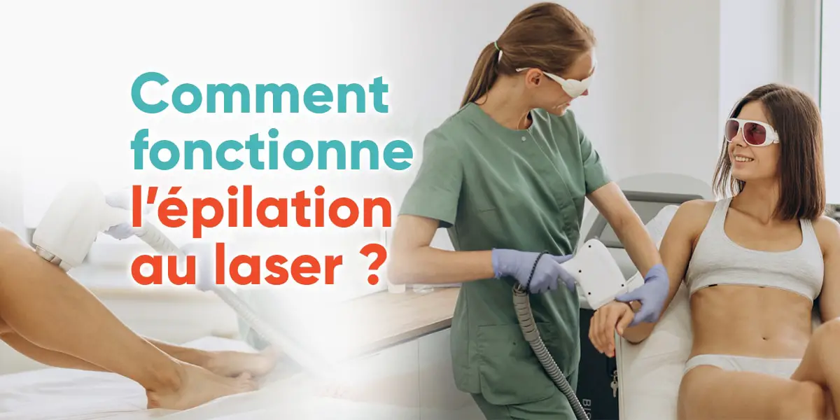 Comment fonctionne l’épilation au laser ?