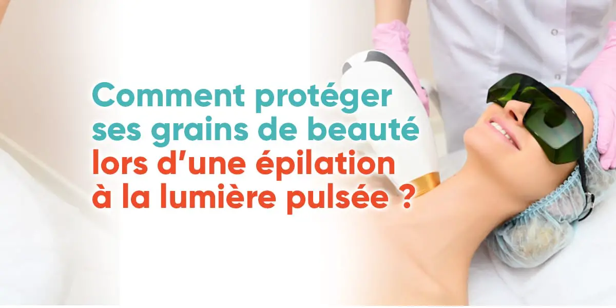 Comment protéger ses grains de beauté lors d’une épilation à la lumière pulsée ?