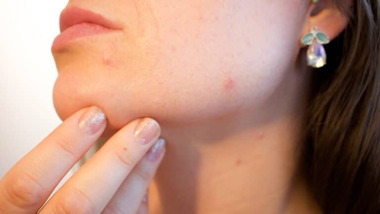 Comment préparer sa peau au peeling ?